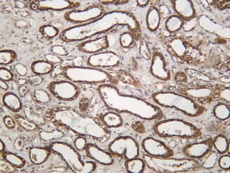 Recombinant TORC2 Monoclonal Antibody - 1