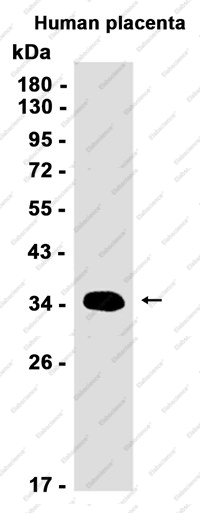 Recombinant HSD17B1 Monoclonal Antibody - 1