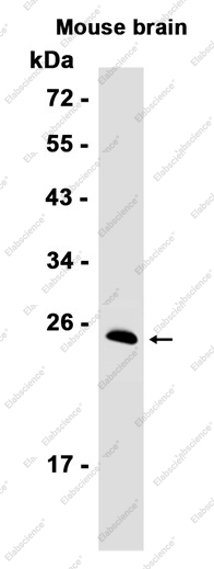 Recombinant SNAP25 Monoclonal Antibody - 2