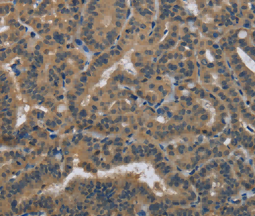 HSP40-4 Polyclonal Antibody - 2