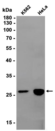 Recombinant IGFBP7 Monoclonal Antibody - 2