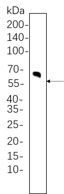 Recombinant Tyrosine Hydroxylase Monoclonal Antibody-searchlist-1