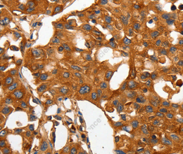 CAP2 Polyclonal Antibody - 2