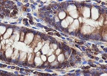 Recombinant NAP1L1 Monoclonal Antibody-searchlist-2