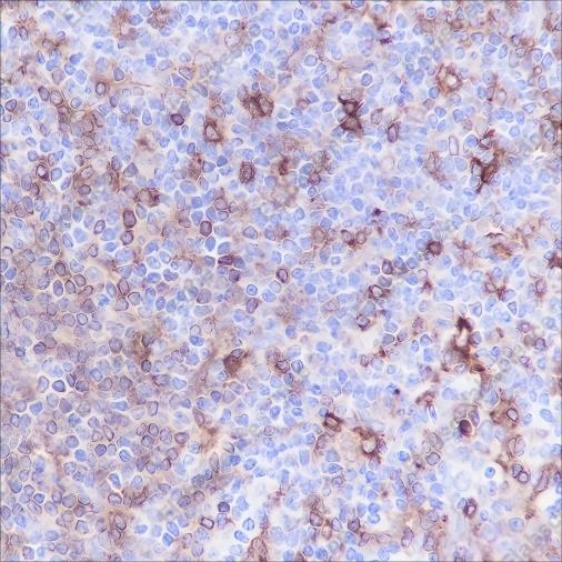 Recombinant HLA-DPA1 Monoclonal Antibody - 3