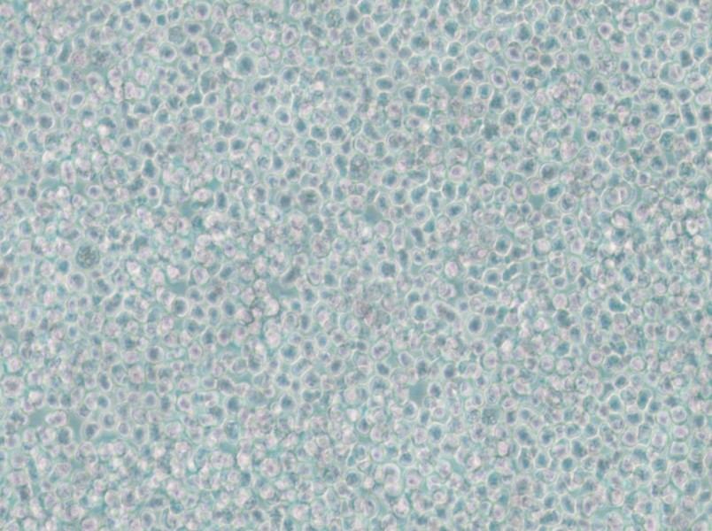 SKNO-1 Cell Complete Medium - 4