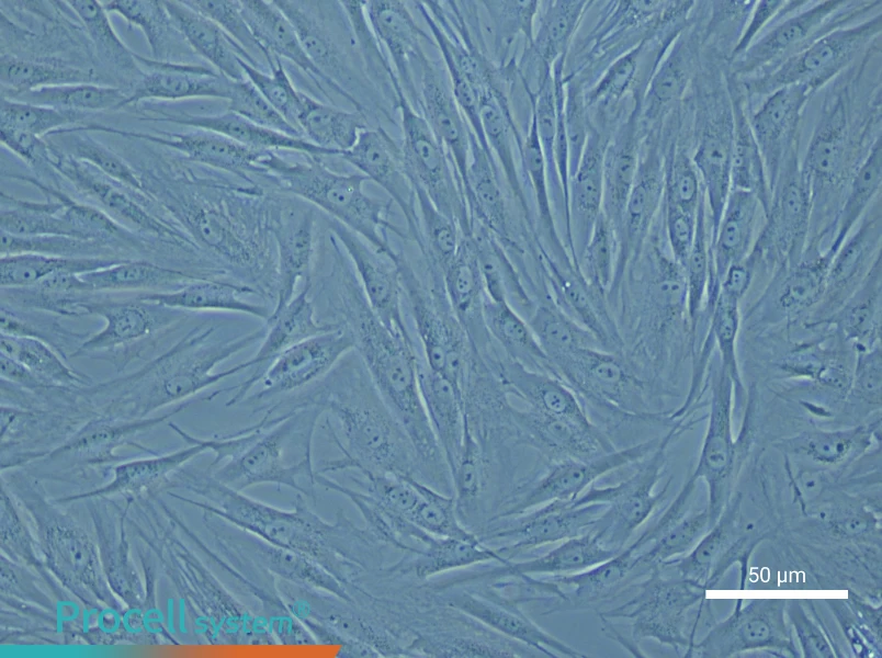 Human Pulmonary Artery Smooth Muscle Cell Complete Medium - small - 5