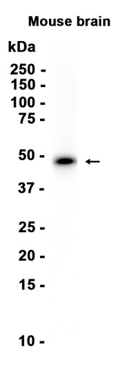 Recombinant Neuroserpin/SerpinI1 Monoclonal Antibody - 1