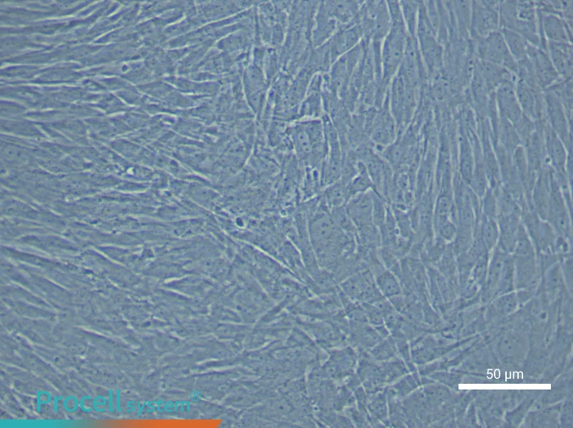 Human Cerebral Artery Smooth Muscle Cell Complete Medium - 5