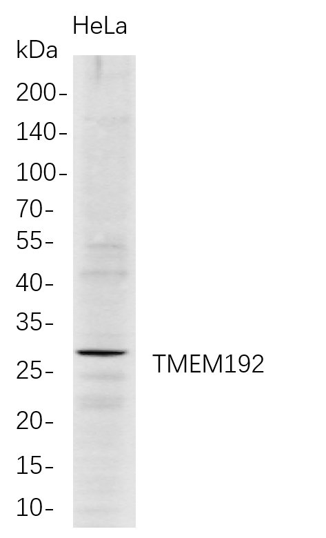 Recombinant TMEM192 Monoclonal Antibody-searchlist-1