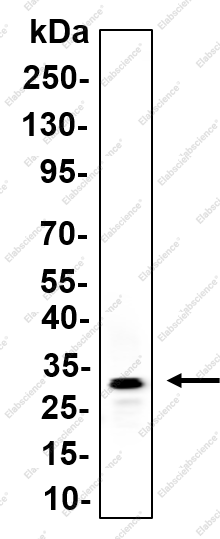 Recombinant UCP2 Monoclonal Antibody - 1