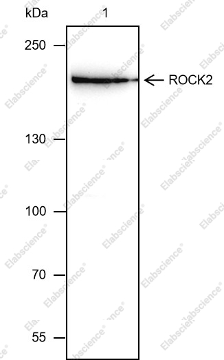 Recombinant ROCK2 Monoclonal Antibody - 1