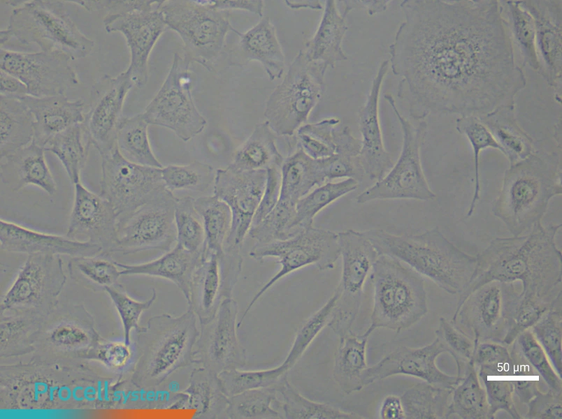 Human Keloid Fibroblast (Primary cell immortalization) Complete MediumHuman Keloid Fibroblast (Primary cell immortalization) Complete Medium - 6
