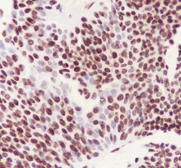 Recombinant DUSP5 Monoclonal Antibody-searchlist-2