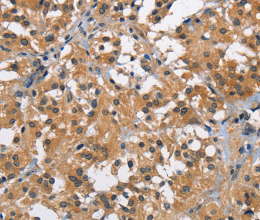 BABAM2 Polyclonal Antibody - 3