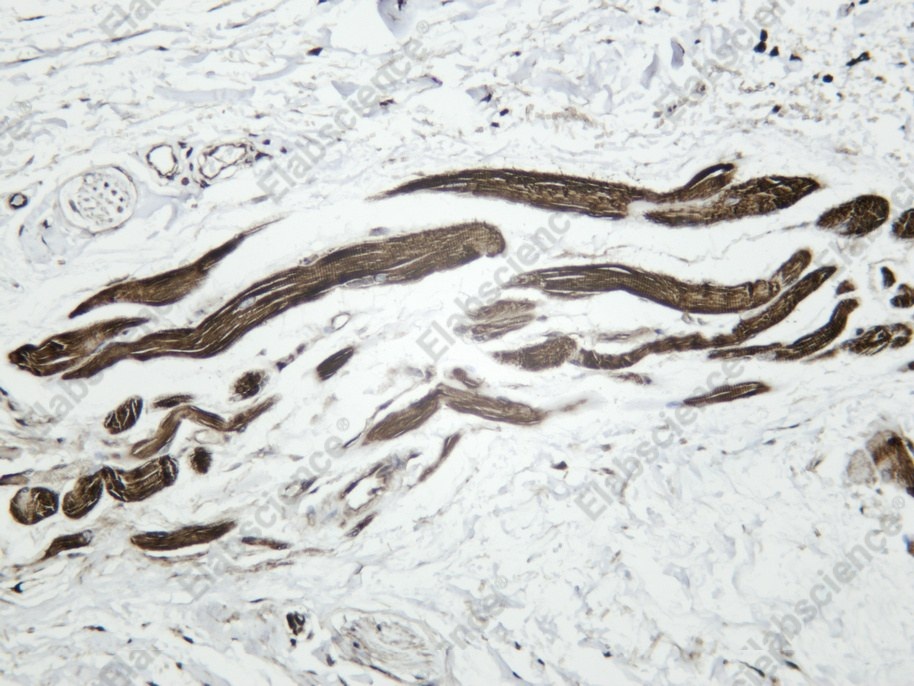 Recombinant RRM2 Monoclonal Antibody - 1