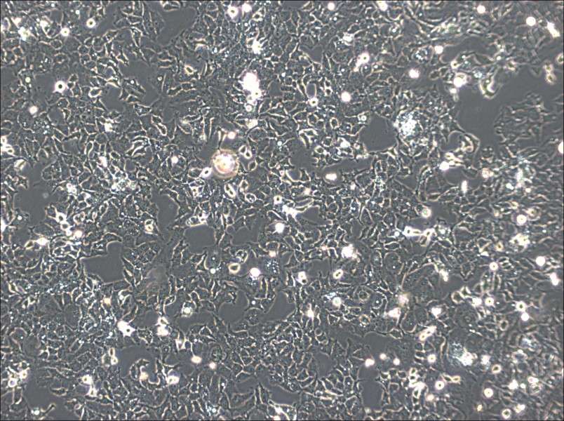 Ishikawa Cell Complete Medium-searchlist-1