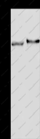 TRIM29 Polyclonal Antibody - 1