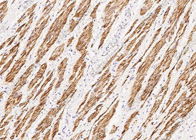 Desmin Monoclonal Antibody - 2