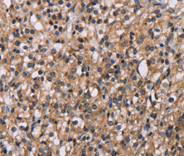GNL3 Polyclonal Antibody - 3