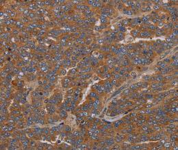 GDF2 Polyclonal Antibody - 2
