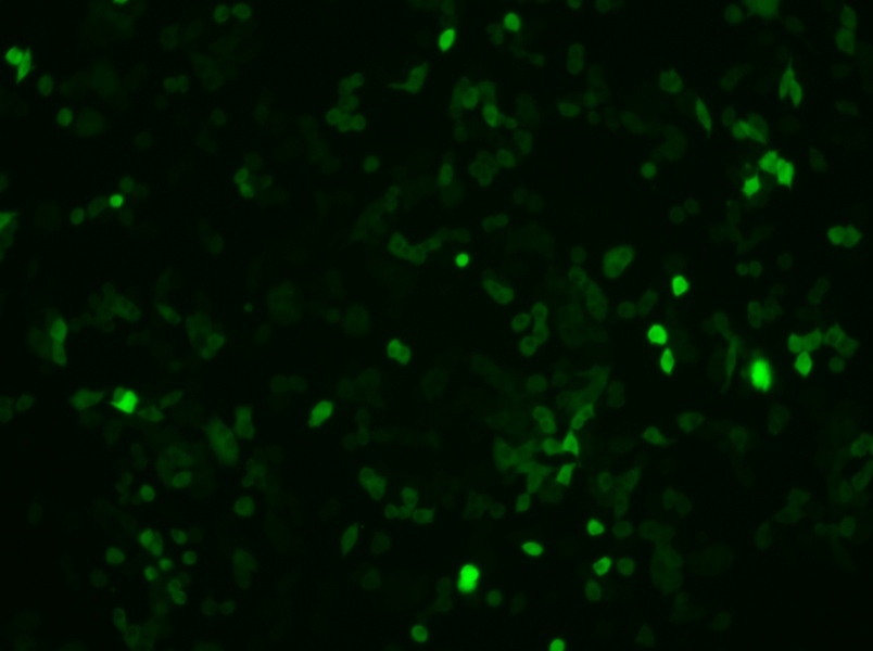 4T1-GFP Cell Complete Medium4T1-GFP Cell Complete Medium - 2