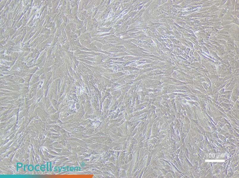 Rat Renal Artery Smooth Muscle Cell Complete Medium - 1