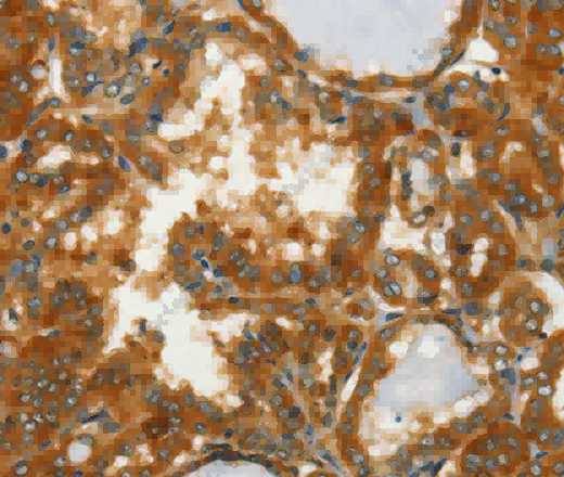 GOT1 Polyclonal Antibody - 2