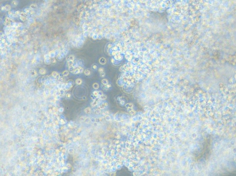 NCI-H2171 Cell Complete Medium - 5