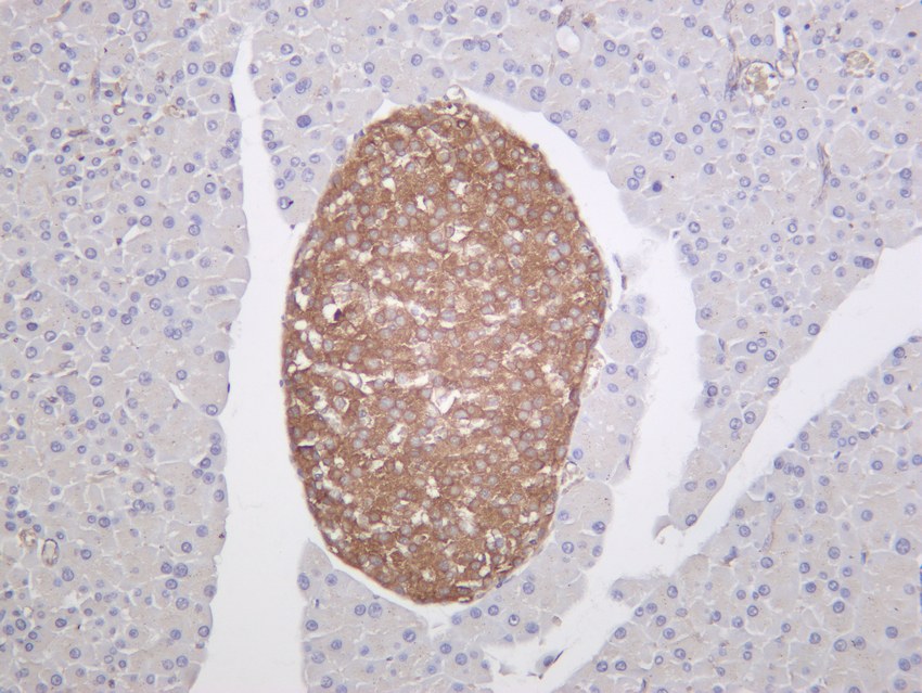 Recombinant DRP1 Monoclonal Antibody - small - 5