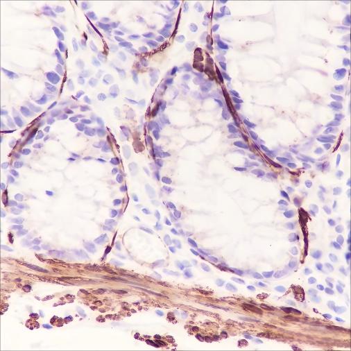 Recombinant Smooth Muscle Myosin heavy chain 11 Monoclonal Antibody - 2