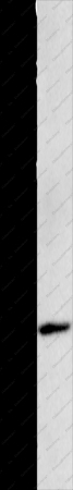 MAGEB4 Polyclonal Antibody - 1