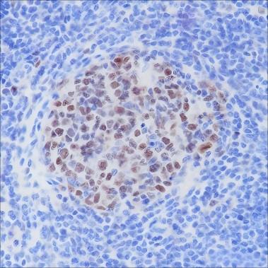 Recombinant BCL6 Monoclonal Antibody - small - 2