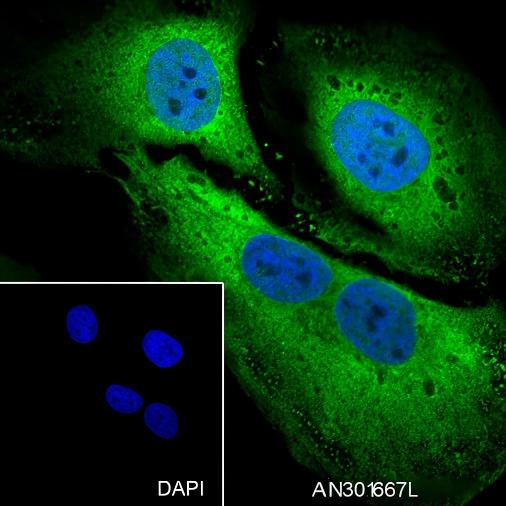 Recombinant STIP1/STI1 Monoclonal Antibody - small - 4