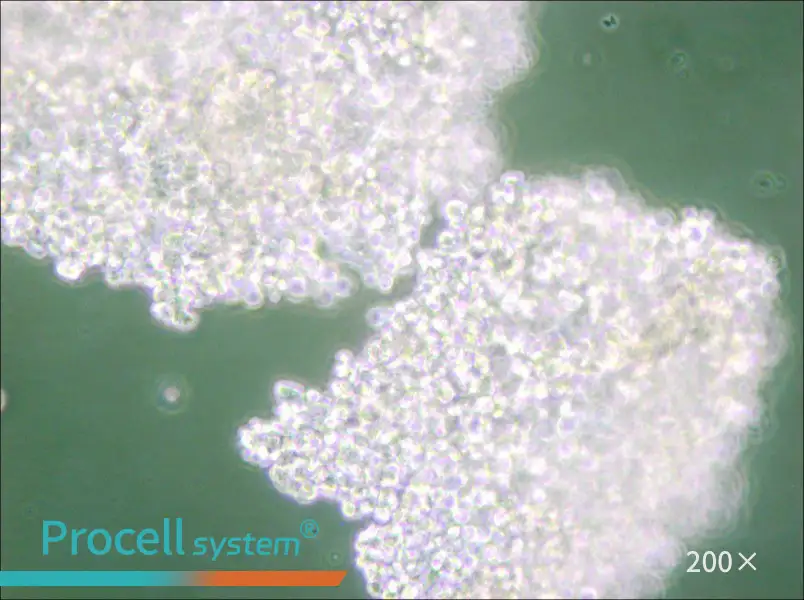 NCI-H146 [H146] Cell Complete Medium - 6