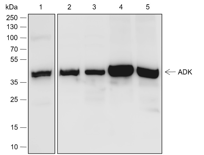 Recombinant ADK Monoclonal Antibody-searchlist-1