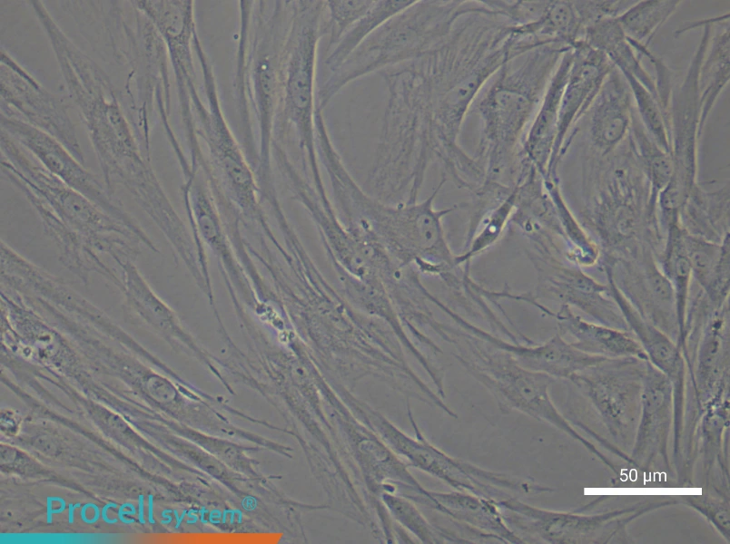 Human Synovial Fibroblast (rheumatoid arthritis) Complete Medium - 4