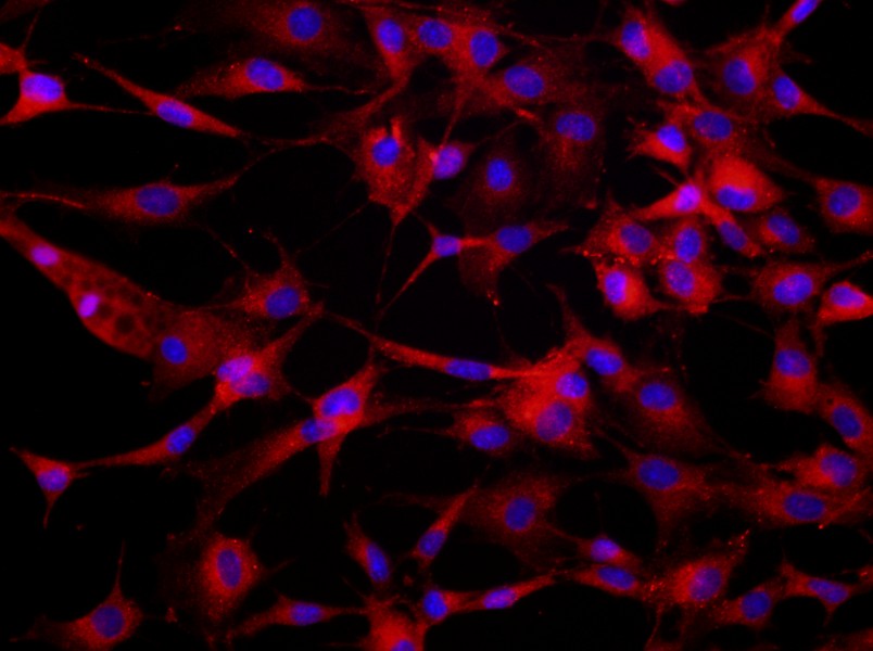 Rat Bone Marrow-Derived Endothelial Progenitor Cell Complete MediumRat Bone Marrow-Derived Endothelial Progenitor Cell Complete Medium - 2
