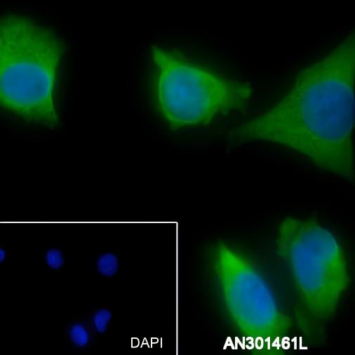 Recombinant CD13 Monoclonal Antibody - small - 7