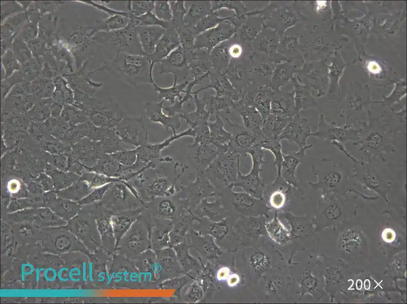 BT-549 Cell Complete Medium - small - 6