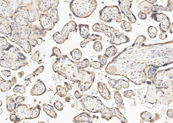 GDF15 Monoclonal Antibody - small - 2