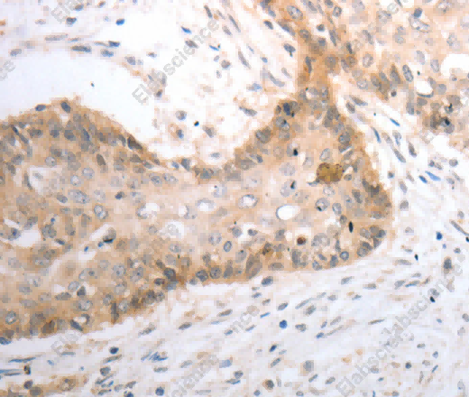 SLC1A4 Polyclonal Antibody - 2