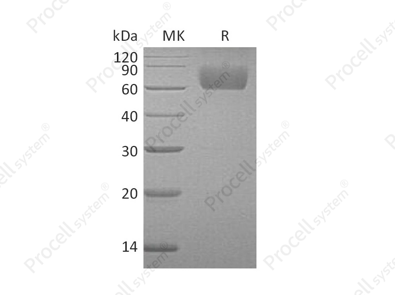FGFR-3/CD333/FGFR3, Human, Recombinant