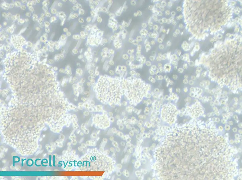P3HR-1 Cell Complete Medium - 2