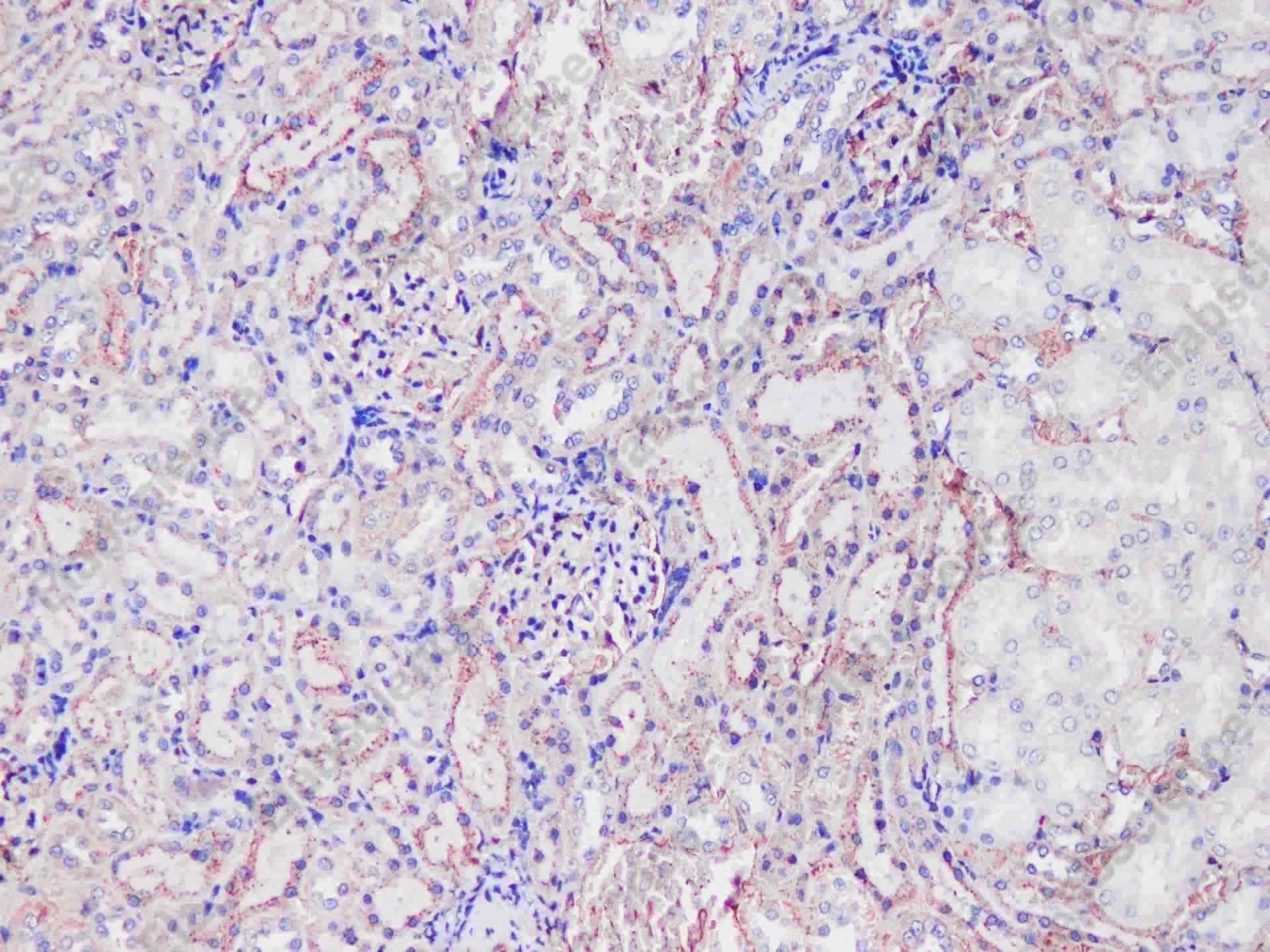 Tf Polyclonal Antibody - 4
