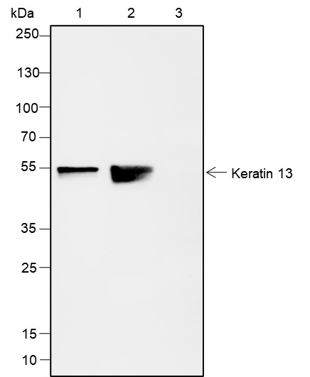 Recombinant Keratin 13 Monoclonal Antibody - small - 5