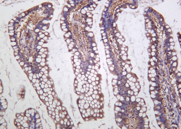 Recombinant Cystathionase Monoclonal Antibody-searchlist-1
