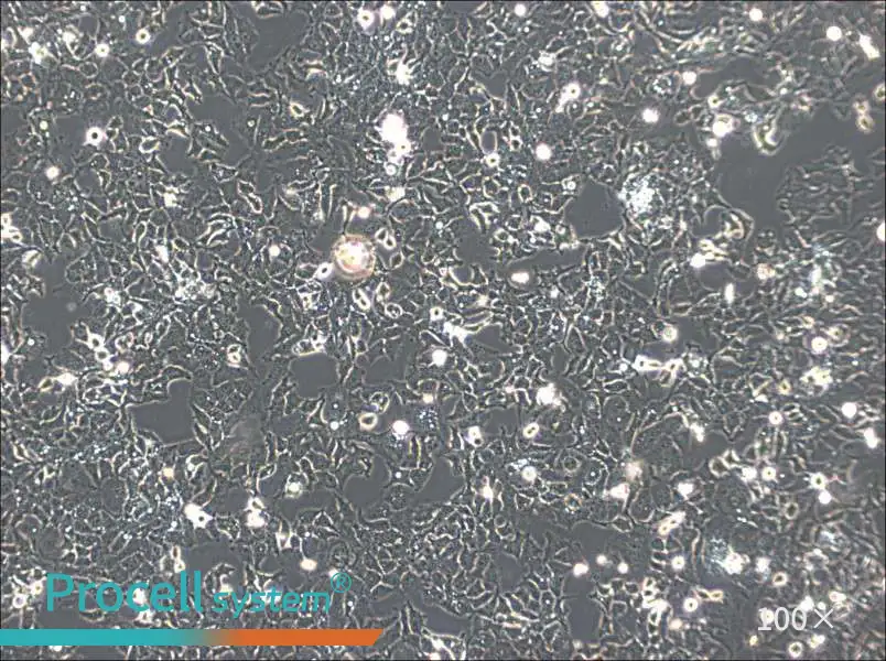 Ishikawa Cell Complete Medium - 1