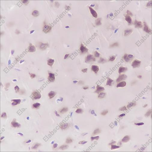 Recombinant eEF1G Monoclonal Antibody - 4