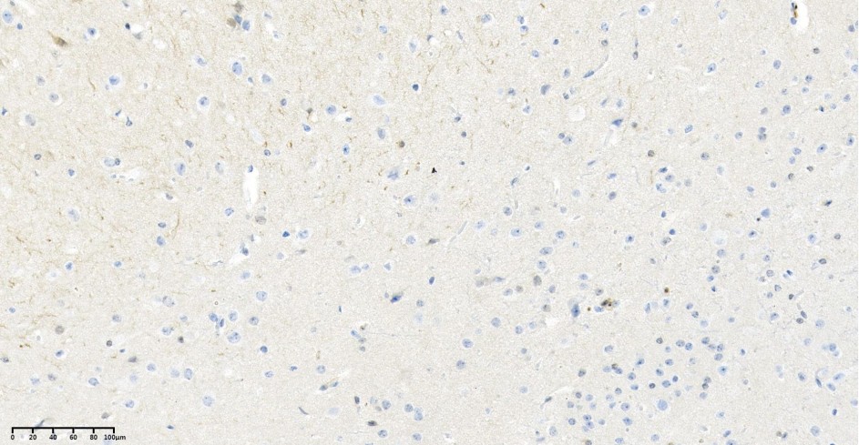 Recombinant Hsp70 Monoclonal Antibody - small - 4